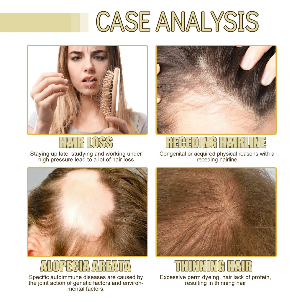Eelhoe Rosemary Dense Hair Essential Oil Softens Prevent Hair Loss Smooth Repairing Hair Root Growth Nourishes Scalp Essence Oil