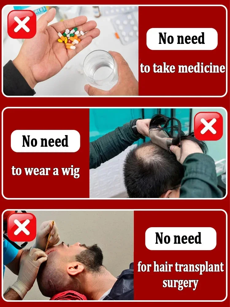 O rei do crescimento do cabelo, até mesmo pessoas calvas podem ter cabelos cheios