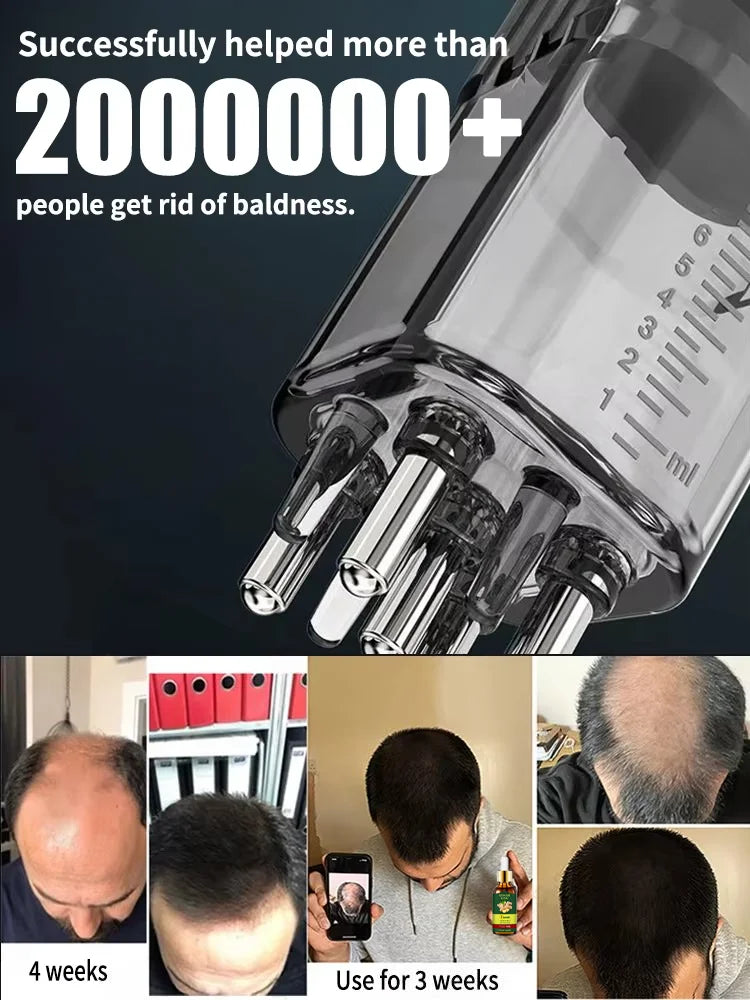Unlock the Secret to Lush Hair: Reviving Dormant Follicles