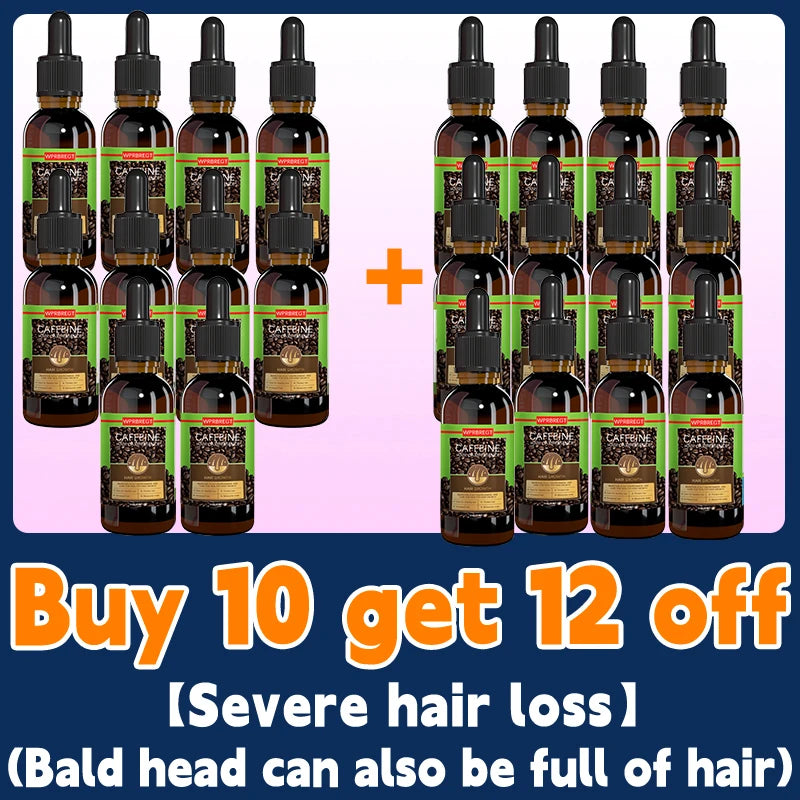 O rei do crescimento do cabelo, até mesmo pessoas calvas podem ter cabelos cheios
