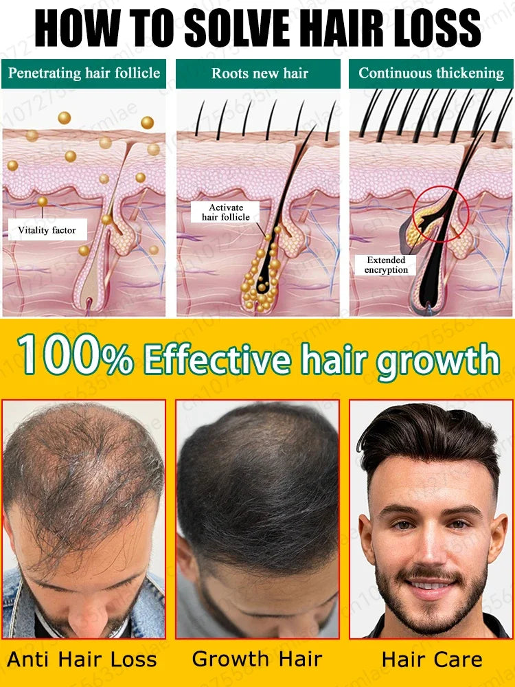 O rei do crescimento do cabelo, até mesmo pessoas calvas podem ter cabelos cheios