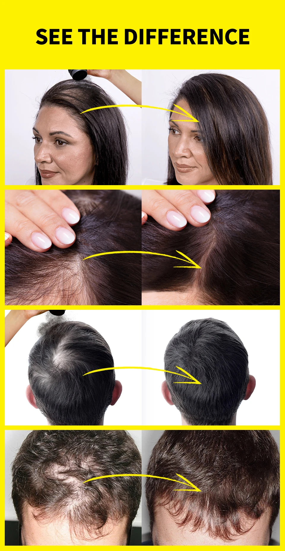 Hair Fibers Regrowth Powders Black Volumizing Hair Fibers Hair Building Fiber Natural Keratin Hair Styling Thickening Powder