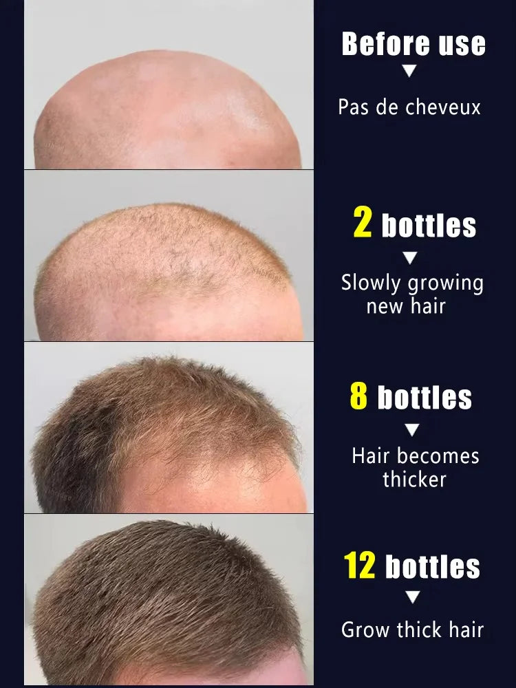Unlock the Secret to Lush Hair: Reviving Dormant Follicles